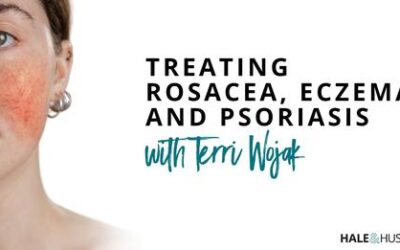 Treating Psoriasis, Rosacea, and Eczema | August Webinar Replay from Hale & Hush